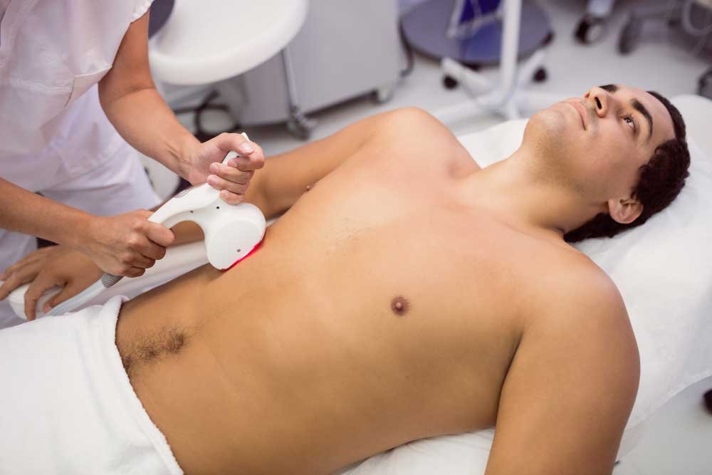Laser Hair Removal