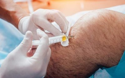 Understanding the Costs and Insurance Options for Regenerative Cell Therapy