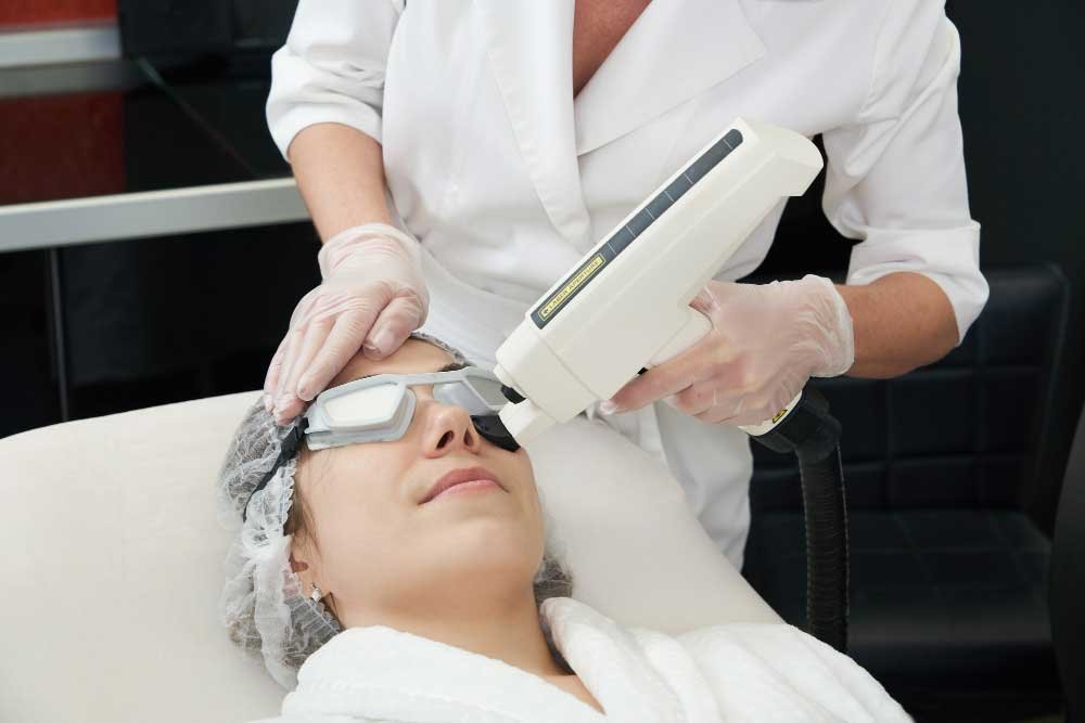 Laser skin resurfacing